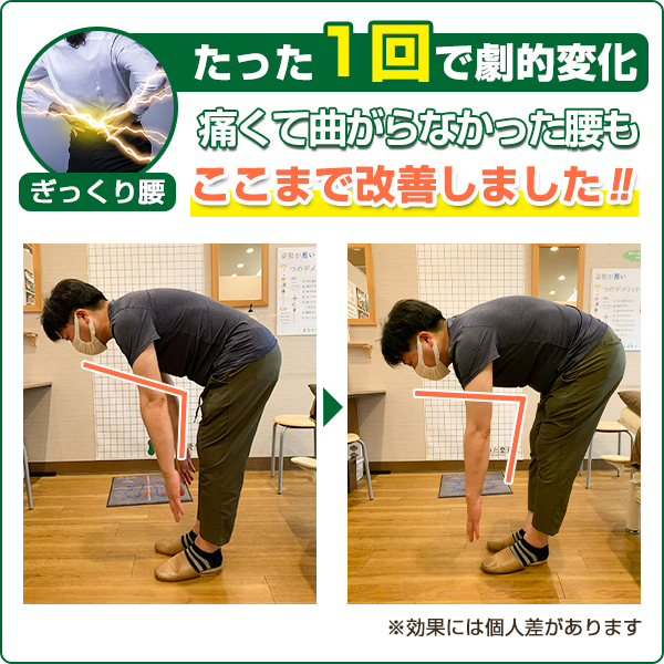 ビフォーアフター