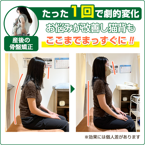 ビフォーアフター